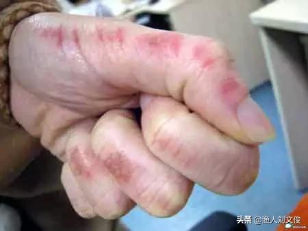 纳米银水产副作用,纳米银在水产上用刺激大吗