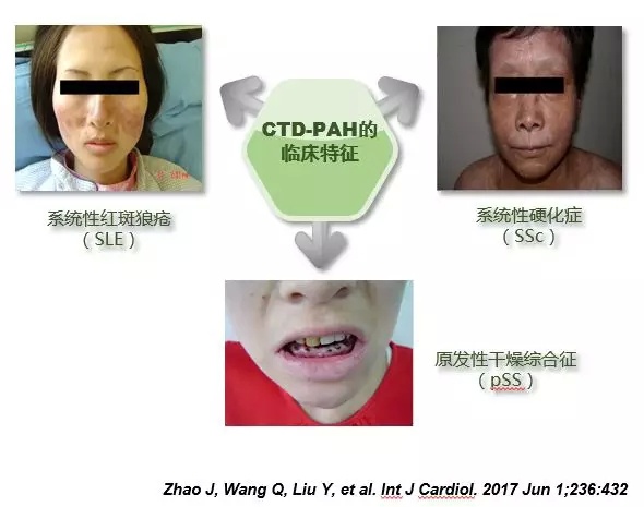 协和医院风湿科发展历程,协和类风湿专家