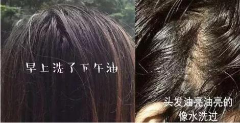 头发蓬松茶树油洗发水,油头救星澳洲茶树洗发水