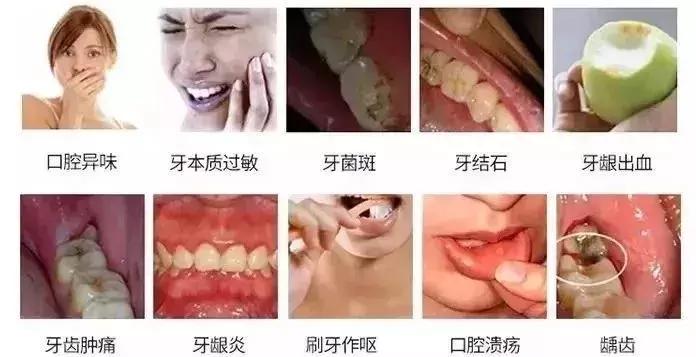 一口黄牙影响颜值,一口黄牙齿