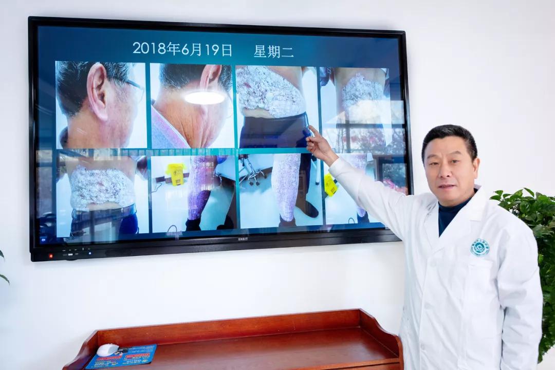 肤研堂银屑病,黄骅哪里治疗银屑病好