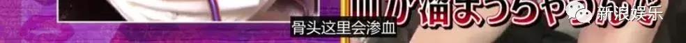 那些整容脸真的觉得自己好看吗,为什么整容以后都是一样的网红脸