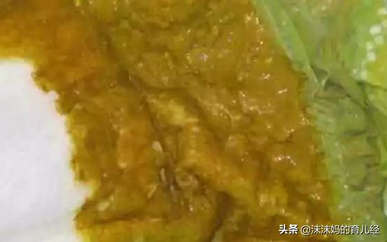 宝宝拉绿色便便还拉稀什么原因,宝宝拉绿色便便是感冒了