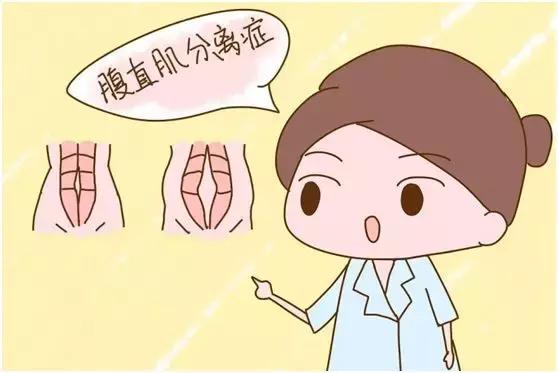 怎样快速解决产后大肚子,产后大肚子大的可怕