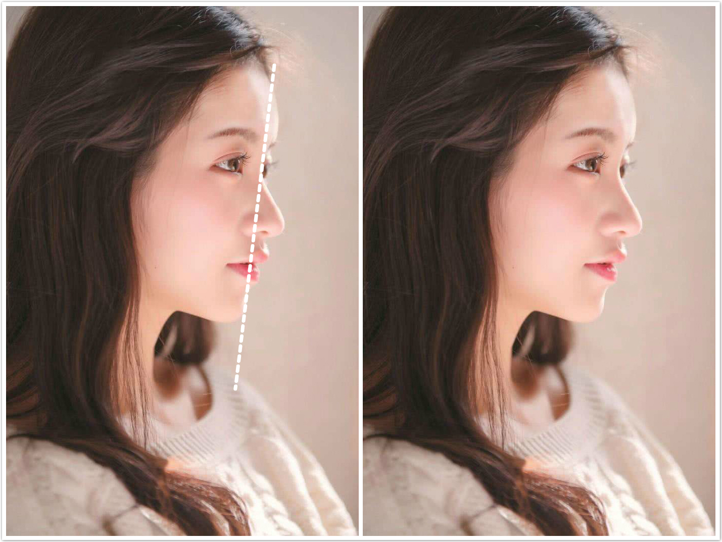 侧面好看和正面好看哪个好,女生侧面怎么才好看