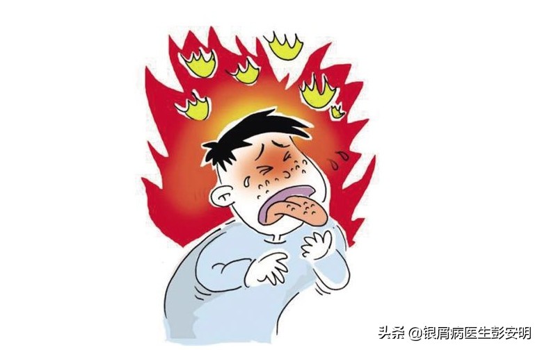 男人每天一把枸杞子,每日一把枸杞子你想不到的功效