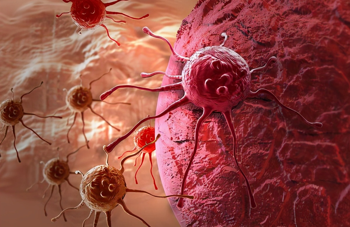 肝癌复发和转移有什么征兆,肝癌术后复发肝内转移能活多久