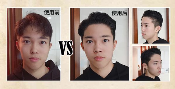 头顶小碎发怎么拉直,头顶炸毛碎发多理发店怎么打理