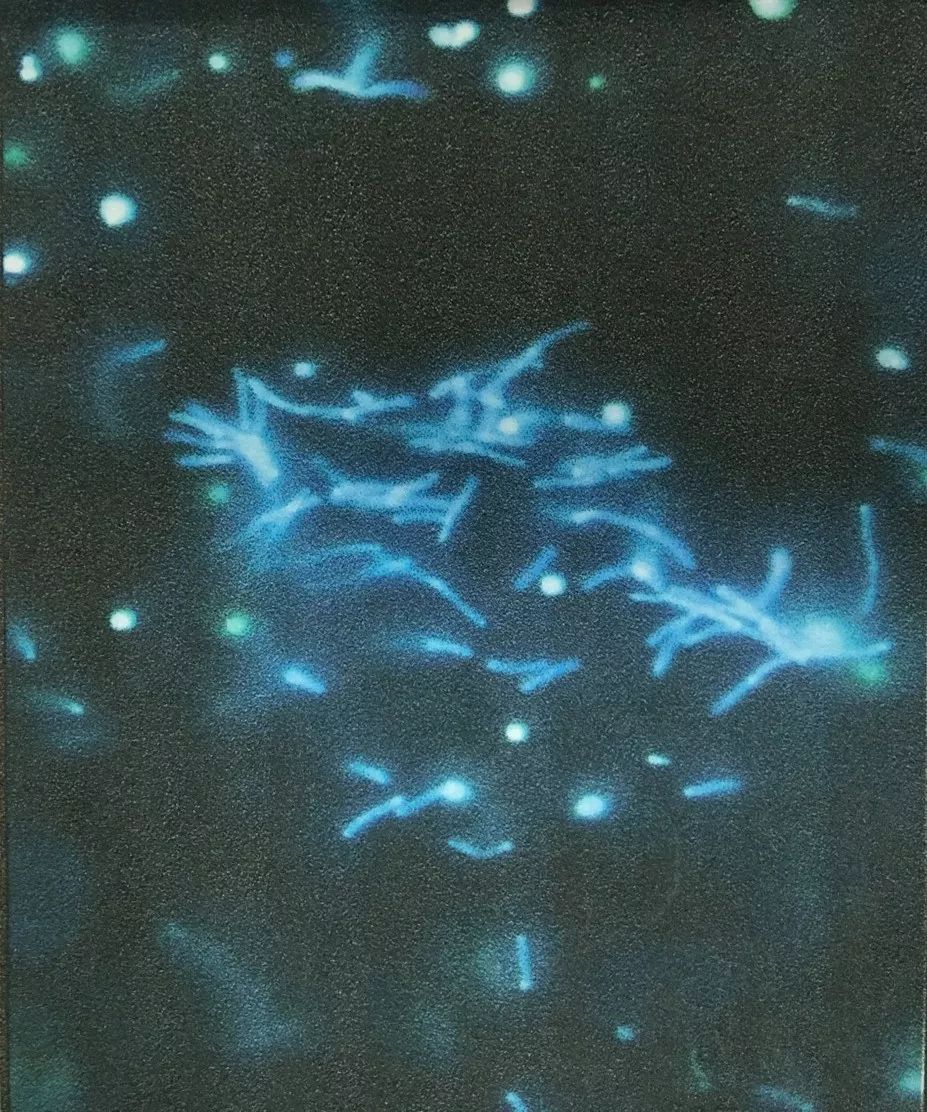 这位抠脚大汉,你下面......不痒吗?