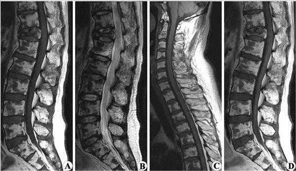 一群外国人打飞的看中医,老外飞中国看病