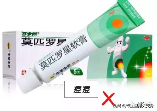 重点纠错被疯传的10款治疗*疮痤**/黑头药膏其实并没有那么神奇