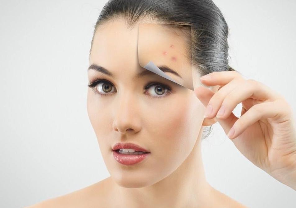 如何区分各种痘印的原因,痘印有哪些种类型