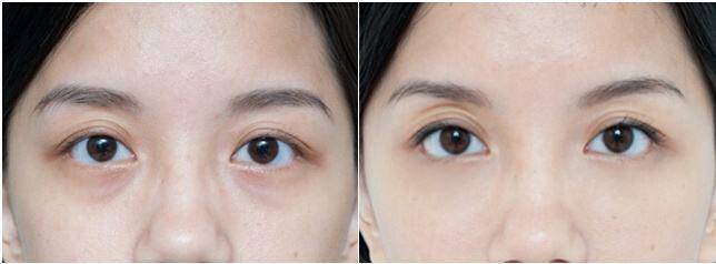 保持眼部健康的建议,眼部的状态每天都会变化吗