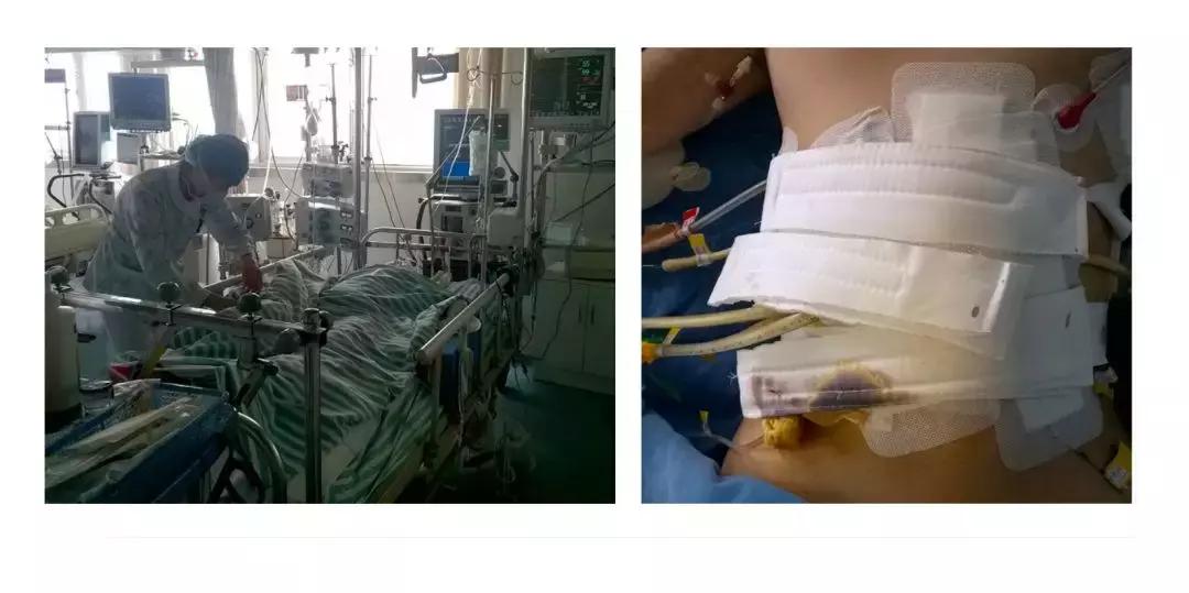 真的有icu吗,到底能相信icu吗