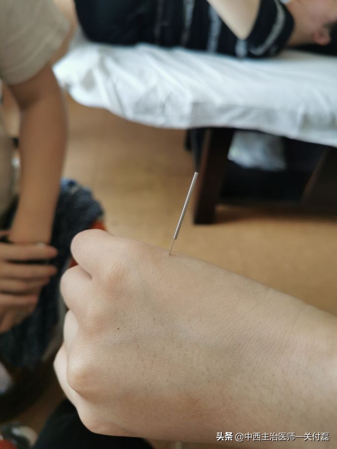 急性落枕手法,急性落枕复位