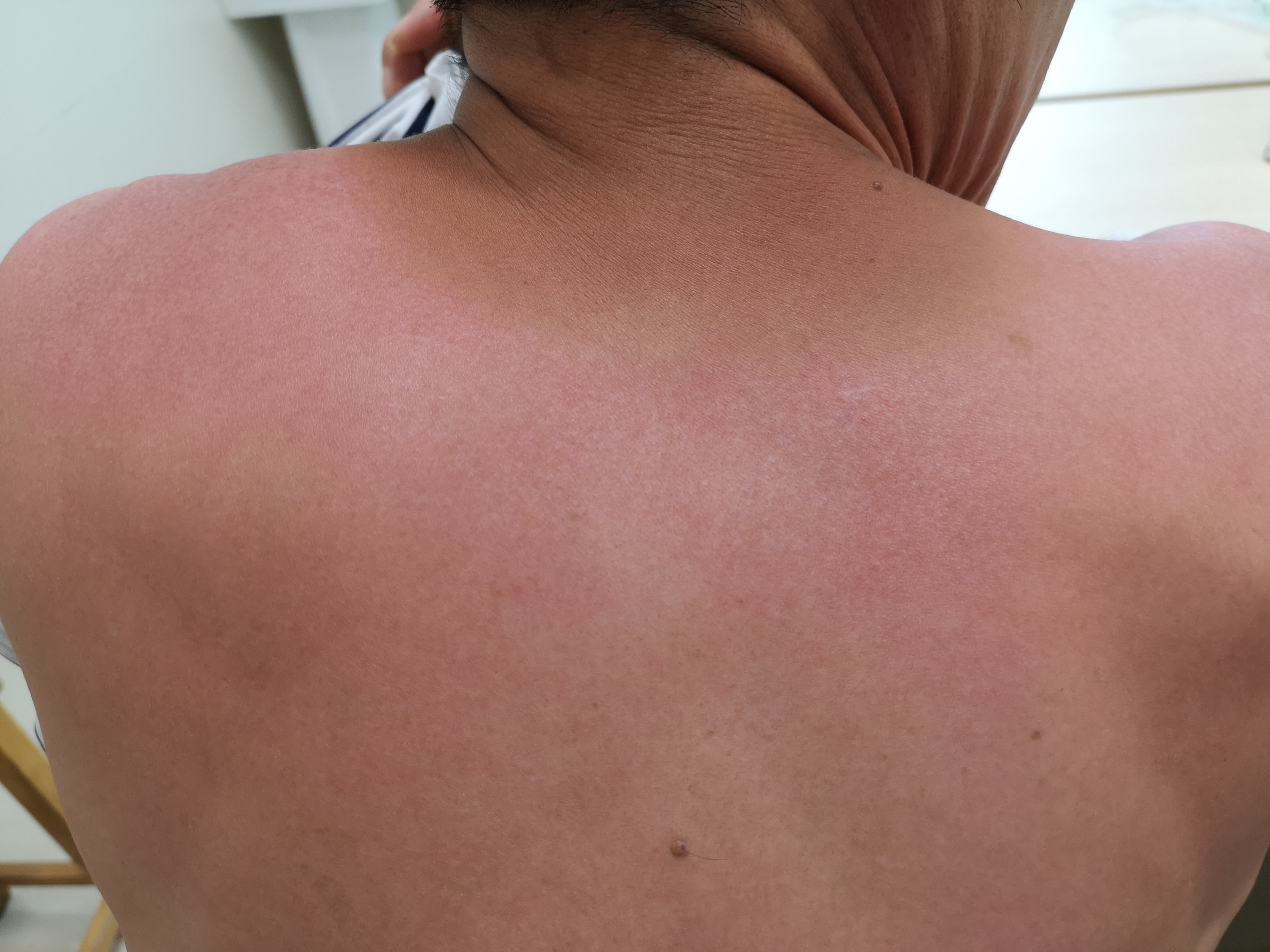 紫外线消毒产品可靠吗,紫外线消毒靠谱吗