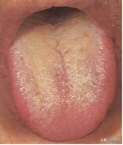 最实用的舌诊图六大舌象,舌诊深入学习书