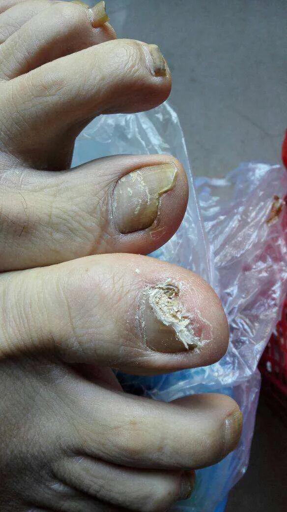 痒痒病怎么治,痒痒用什么中草药止痒最好