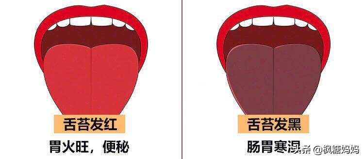 小孩舌头脾胃区有裂纹怎么调理,宝宝脾胃总是弱舌苔又厚怎么调理