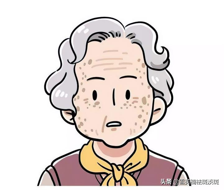 去斑点的最好方法淡斑小妙招,斑点淡斑最好的方法