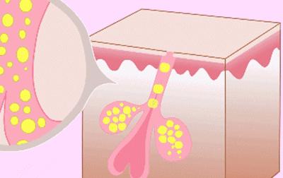 干燥起皮用什么身体乳好一点,为什么手臂干燥有死皮