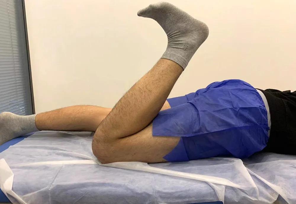 前叉术后多久可以爬楼梯训练,前叉术后怎么进行上下楼梯练习