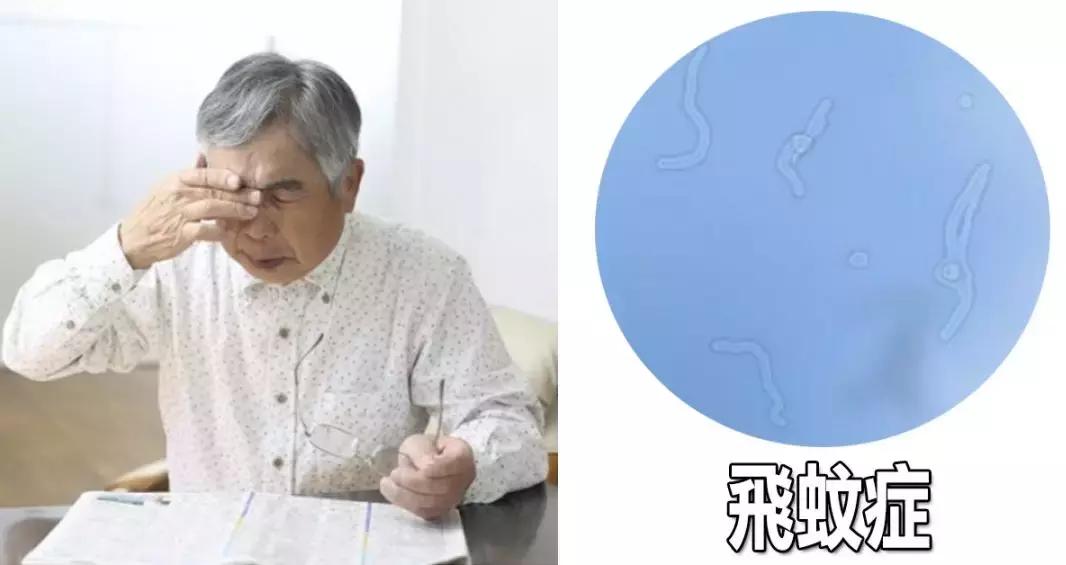 眼前一直有蚊子是什么病,眼前总有蚊子飞怎么治呀