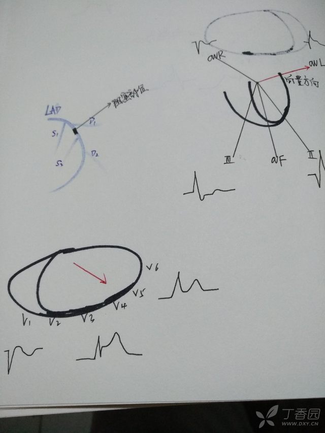 心电图心肌缺血冠脉造影正常,心脏彩超心电图冠脉造影正常