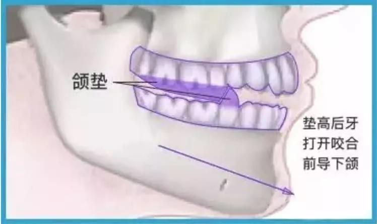 嘴突逆袭,被嘴耽误颜值