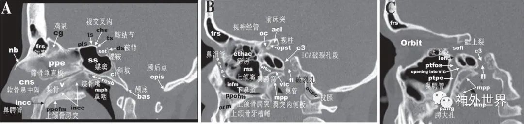 颅底骨折合并脑脊液漏伤情鉴定,颅底骨折伴脑脊液漏右眼眶骨折