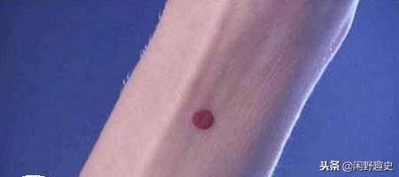 守宫砂为什么若隐若现,守宫如果吃守宫砂怎么办