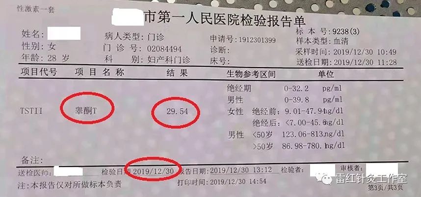 多囊卵巢综合征患者能自然怀孕吗？