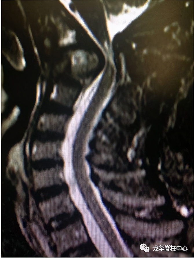 深圳市龙华区人民医院脊柱外科简介