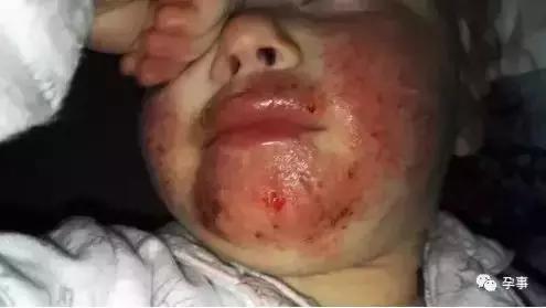 薛之谦微博晒娃被打脸称摆拍作秀,薛之谦被小孩打脸视频