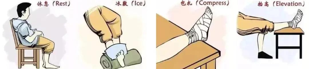 崴脚为什么会有后患,崴脚后治疗不彻底会有后患吗