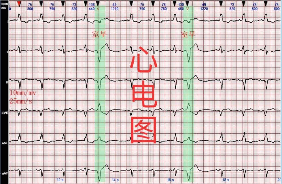 拔牙，就是简单的将牙齿扯出，真是这样吗？|口腔医生：拔牙无小事