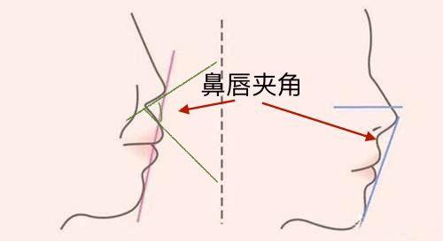 骨相凹陷怎么办,骨相扁平怎么改善