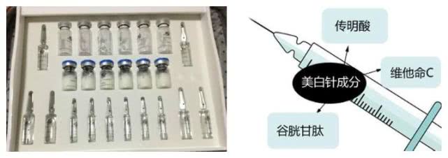 大s美白针一个疗程几针,大S美白针效果如何