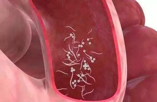 9岁男孩屁股又疼又痒，到医院一看，10多条虫子从肛门爬出