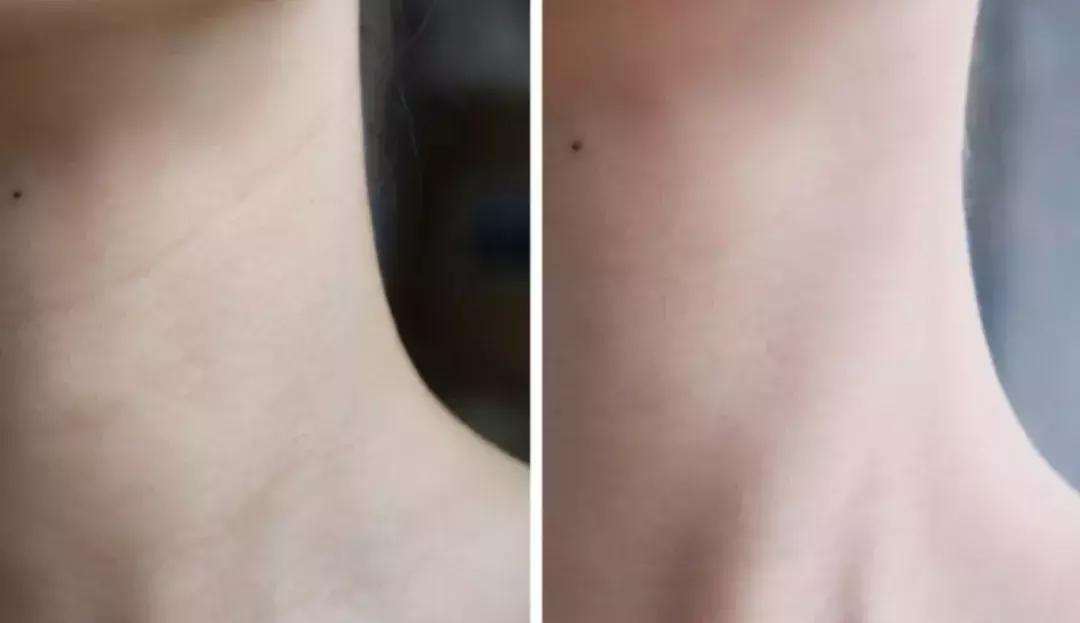 这些护肤成分不要混着用,护肤成分没选对会烂脸