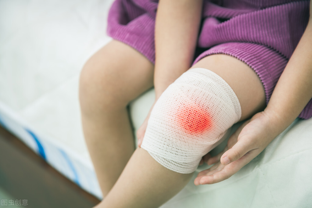 白癜风患者经常熬夜会加重病情吗,白癜风患者养狗会加重病情吗