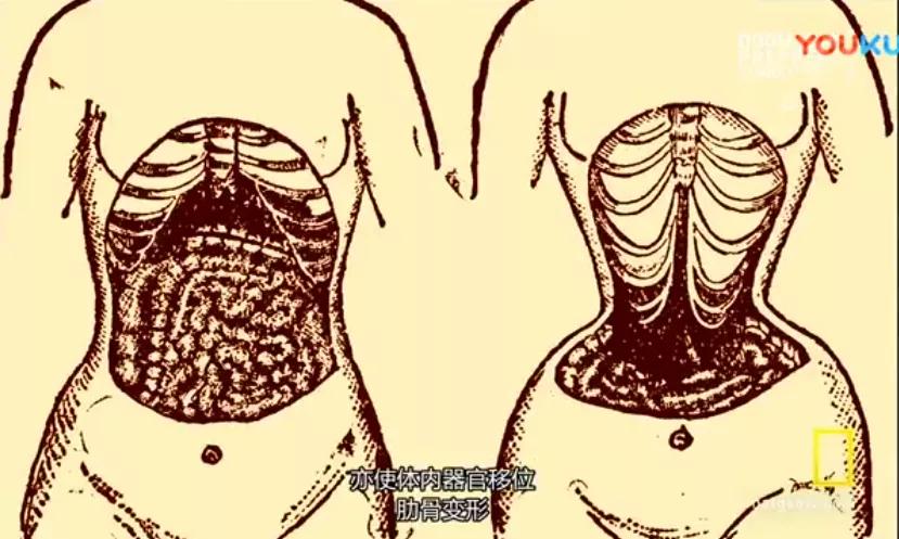 汕头人民一*工罢**,全世界都要穿不上内衣了?