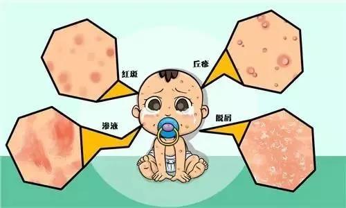 婴儿毛细血管瘤3个办法消退,婴儿毛细血管瘤什么原因