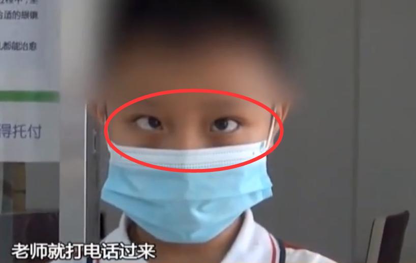 一小孩变斗鸡眼,小孩突然成斗鸡眼