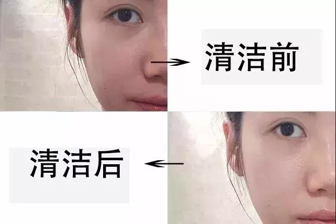 88元享388元「棉花糖SPA」套餐！火遍小红书の贵妇级护肤厦门也有