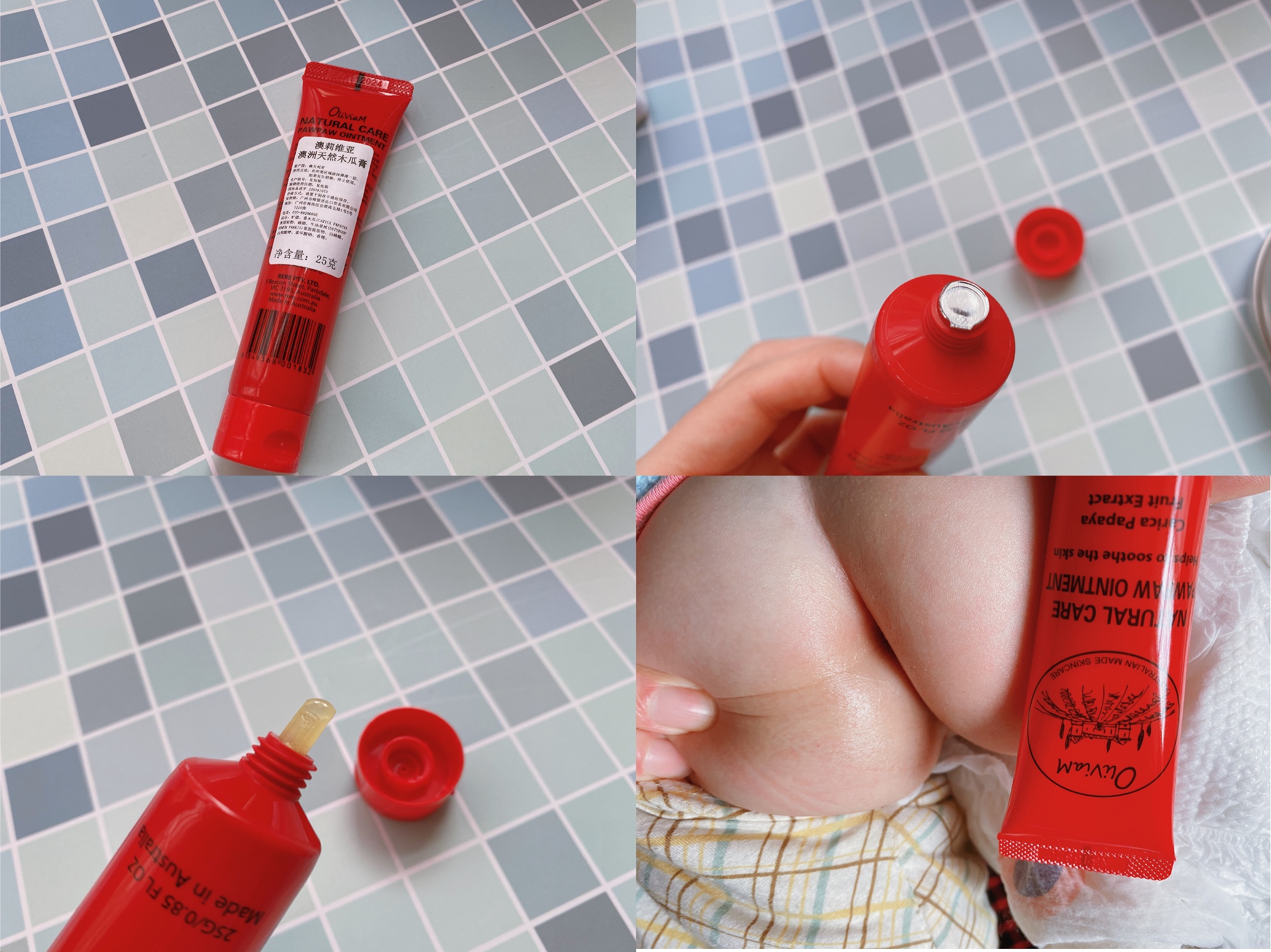 澳洲木瓜膏可以祛痘么,澳洲木瓜膏真的可以祛痘痘吗