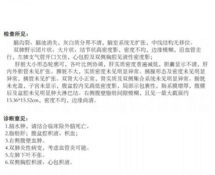 孕妇恶心呕吐,误以为是肠炎,却把性命丢了