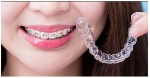 矫正牙齿很难受是怎么坚持下来的,矫正牙齿的过来人的忠告