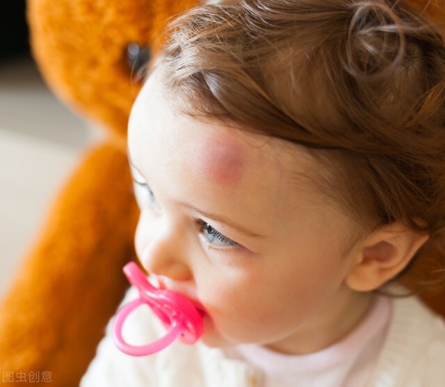 「轩轩妈育儿团队」宝宝摔伤后第一时间应该如何处理？