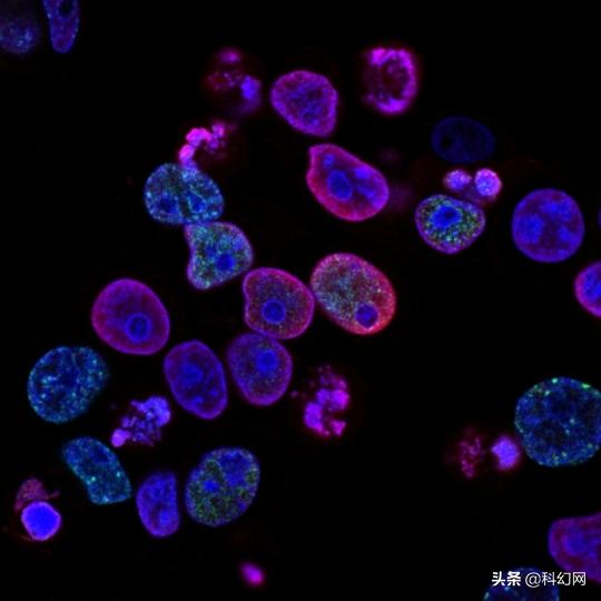 抗抑郁药物能够治疗癌症？